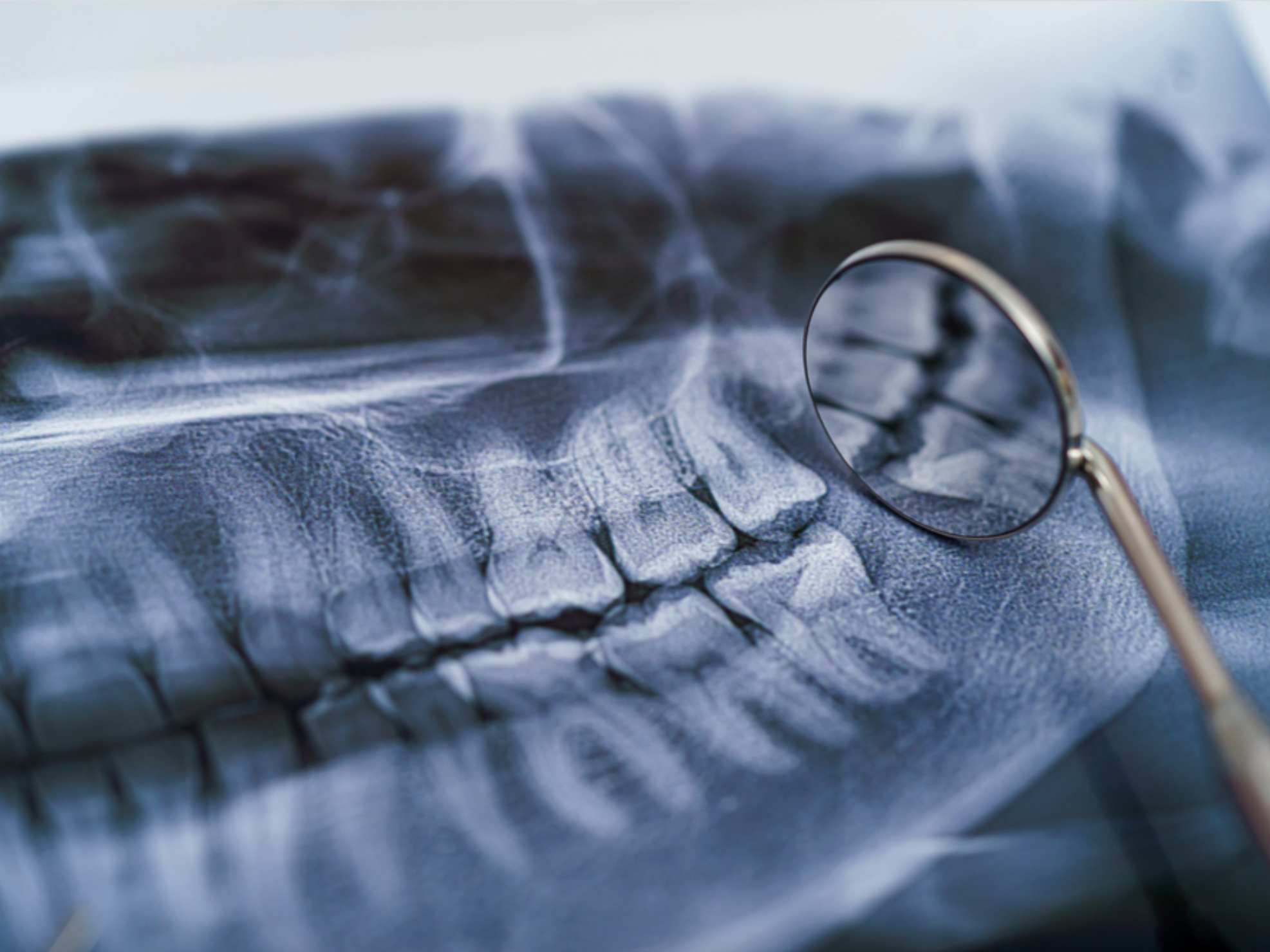 Pre and post-surgical orthodontics